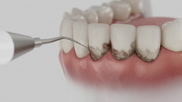 Reliable Wisdom Tooth Removal contractor in Osceola County County, FL by Dentist Open Now